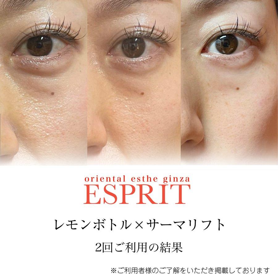 目の下のたるみ・ふくらみ解消をエスプリで