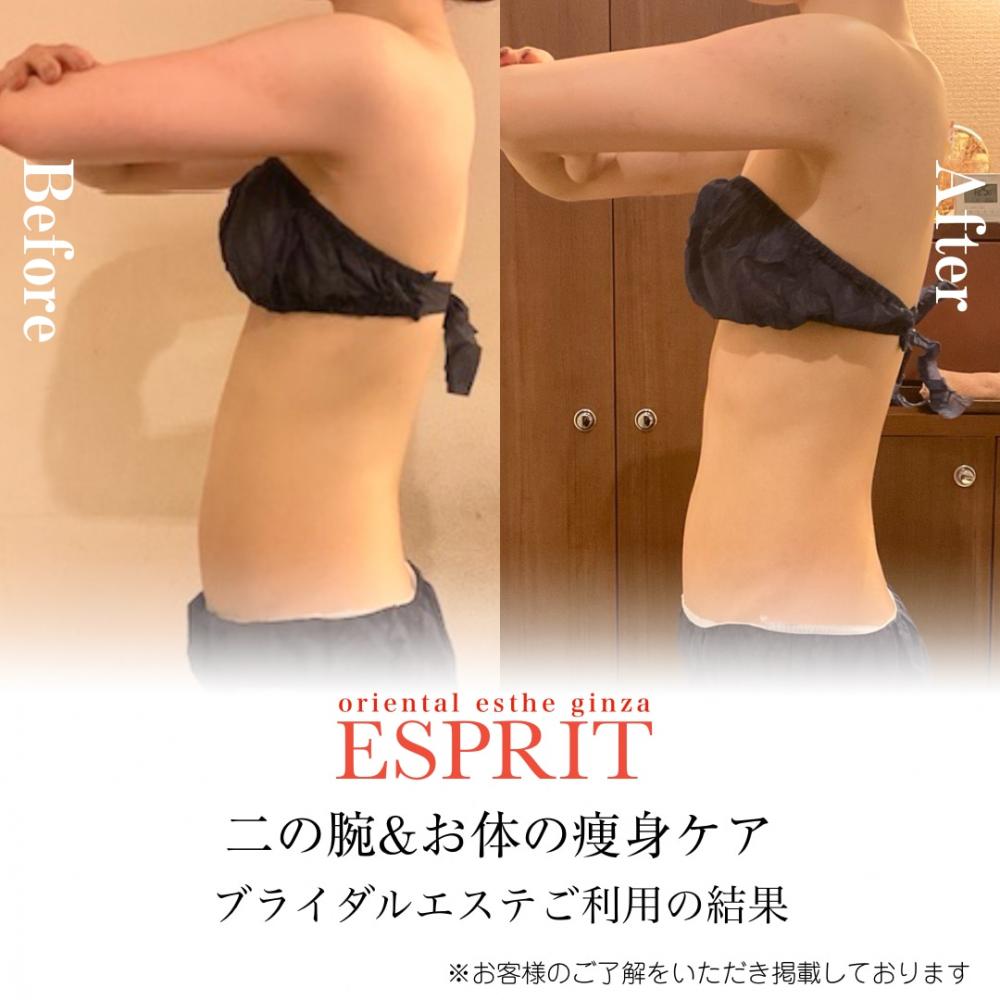 ブライダルエステで二の腕やせ