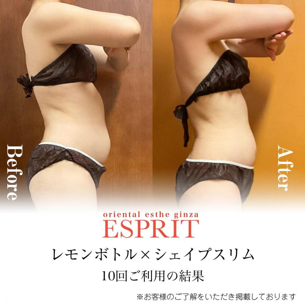 レモンボトル×セルライトゼロ×パワーレメディ