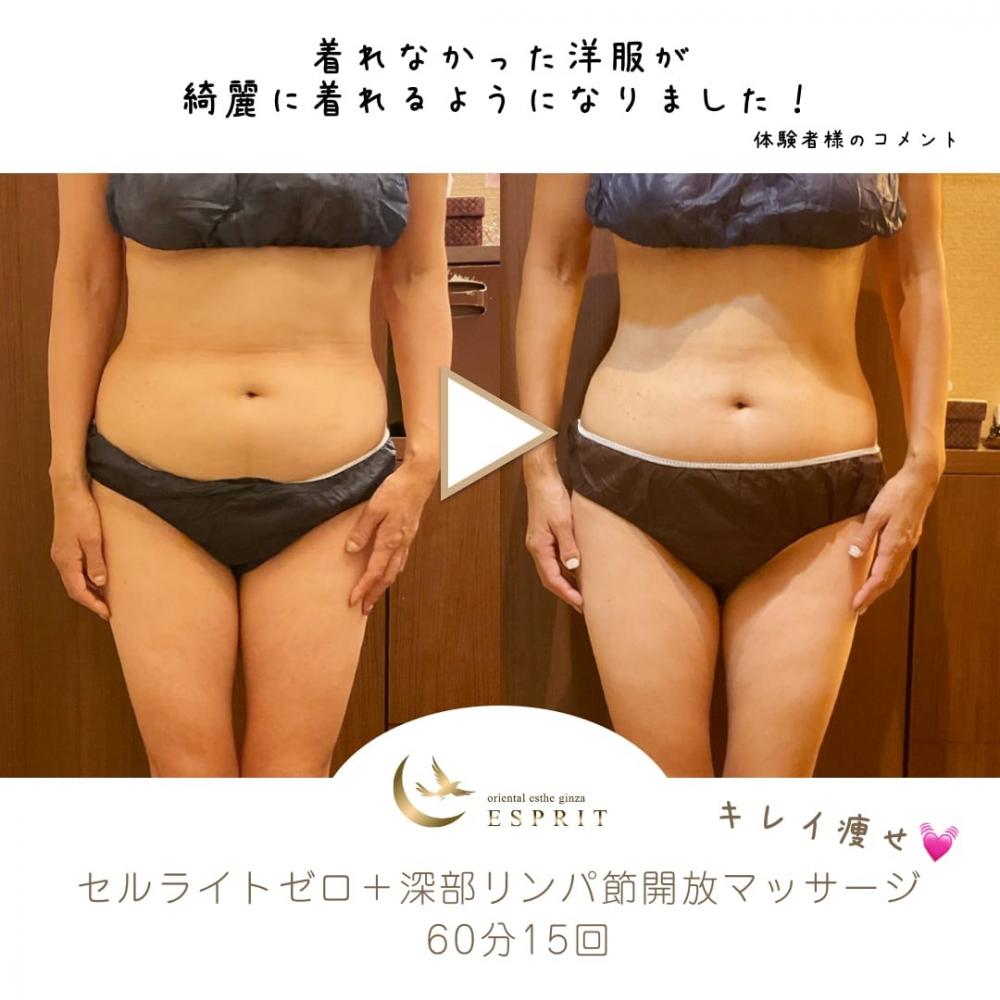 6大痩身セルライトゼロNEO ｜銀座、新宿のエステサロン 痩身＆肌改善 