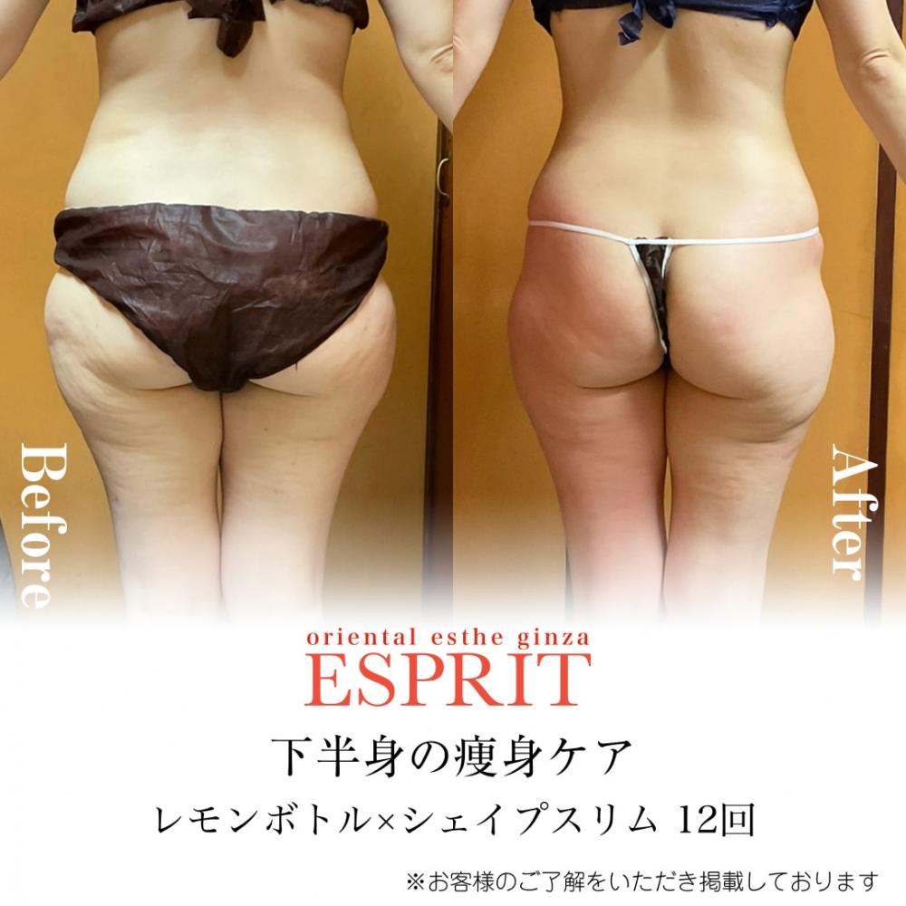 下半身の変化がすごい レモンボトル×シェイプスリム12回で−8kg達成!