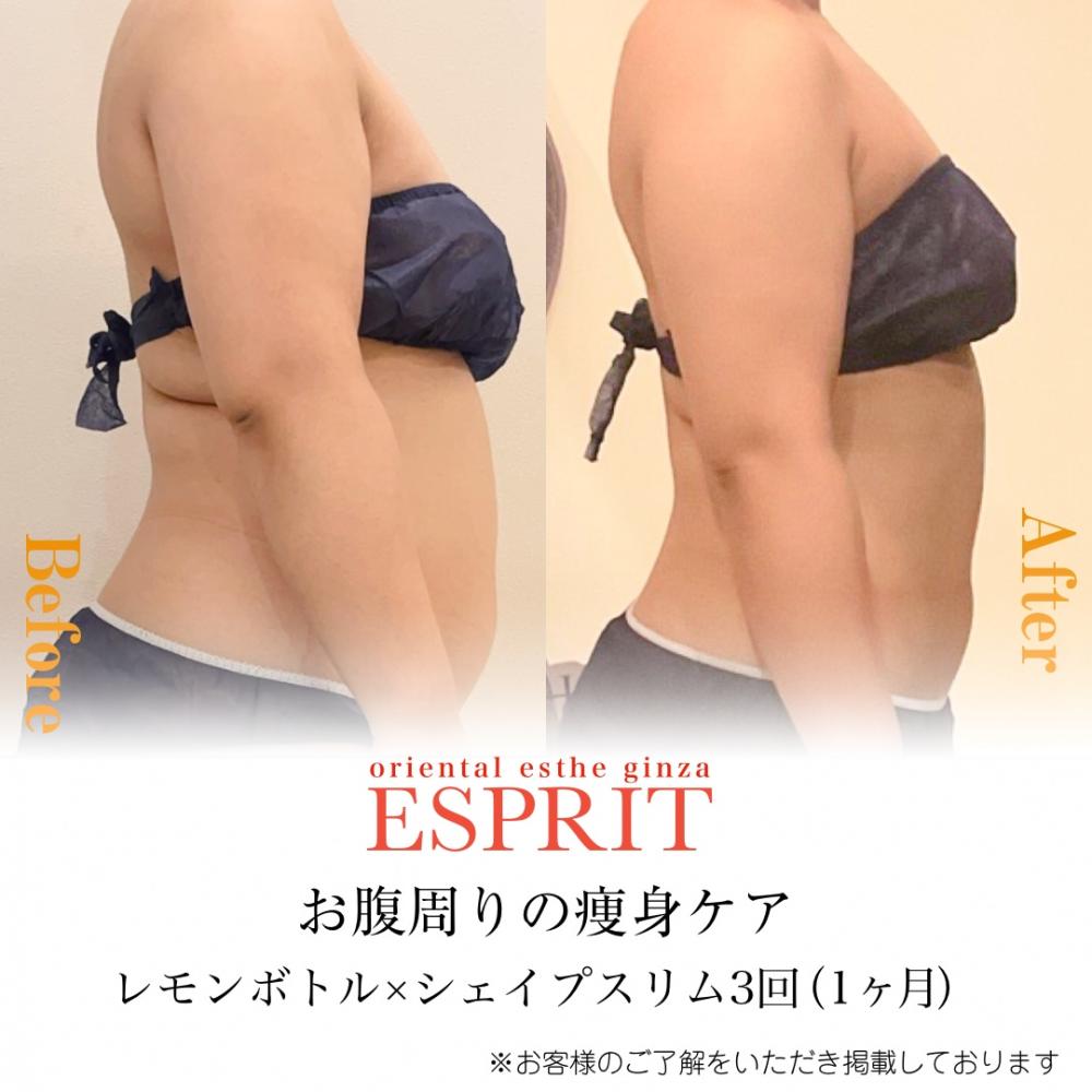 お腹周りの部分痩せ【Before→After】