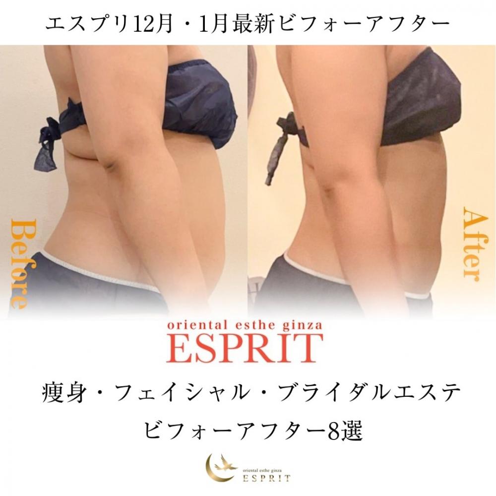 【痩身・肌改善の事例】2025年12月・2026年1月ビフォーアフター8選|銀座・新宿エスプリ