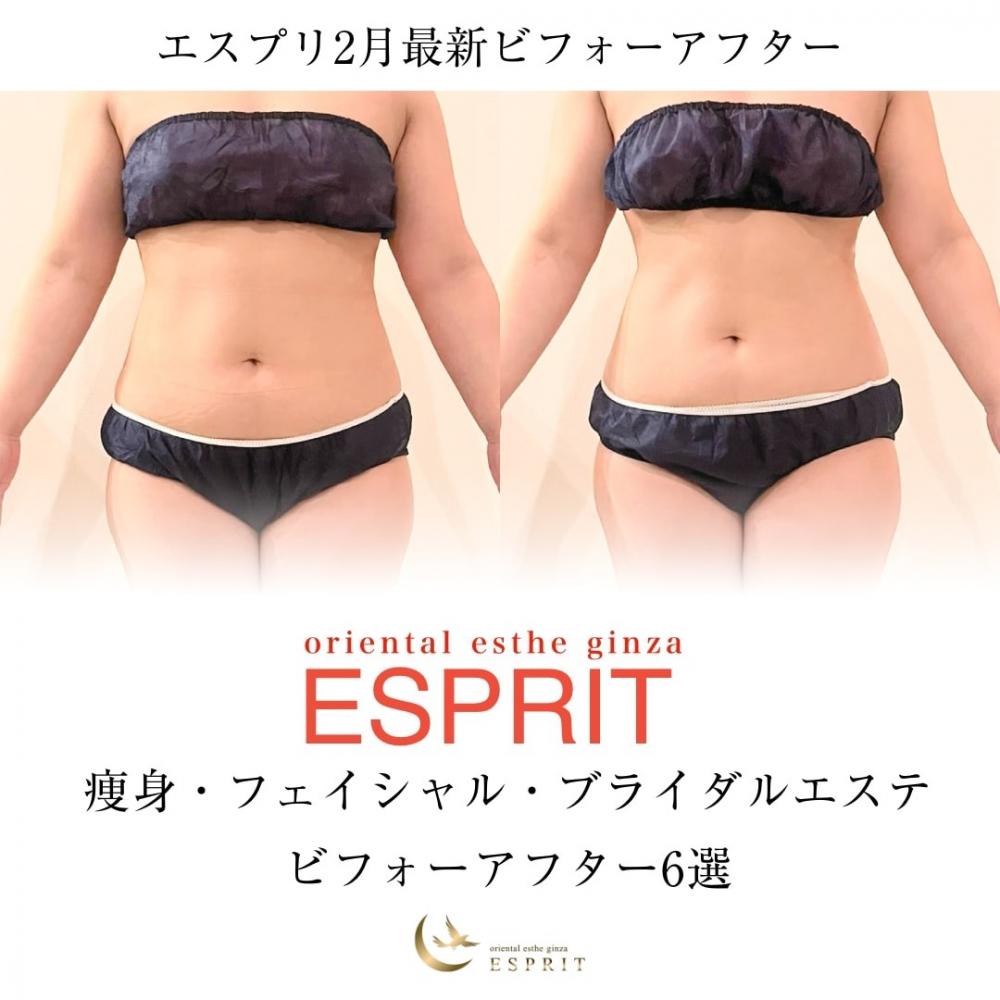 【痩身・小顔エステの事例】2026年2月ビフォーアフター|銀座・新宿エスプリ