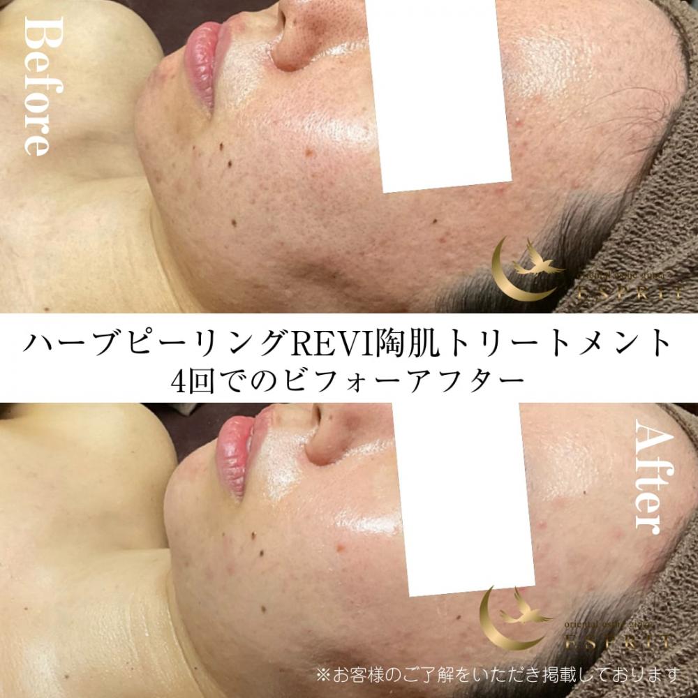 肌改善サポートのビフォーアフター!