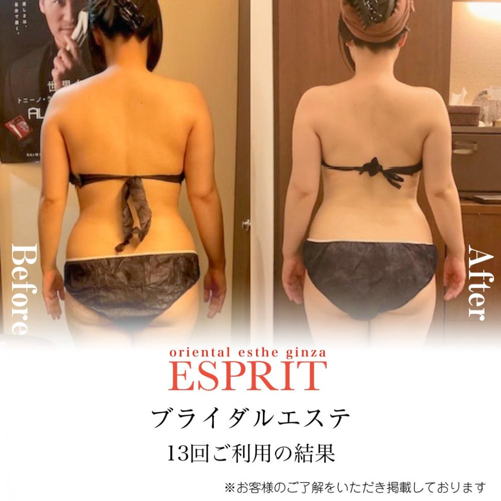 ブライダルエステコースのビフォーアフター