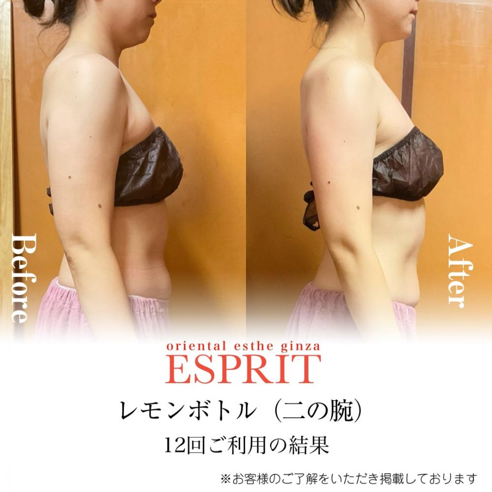 レモンボトルで二の腕やせ