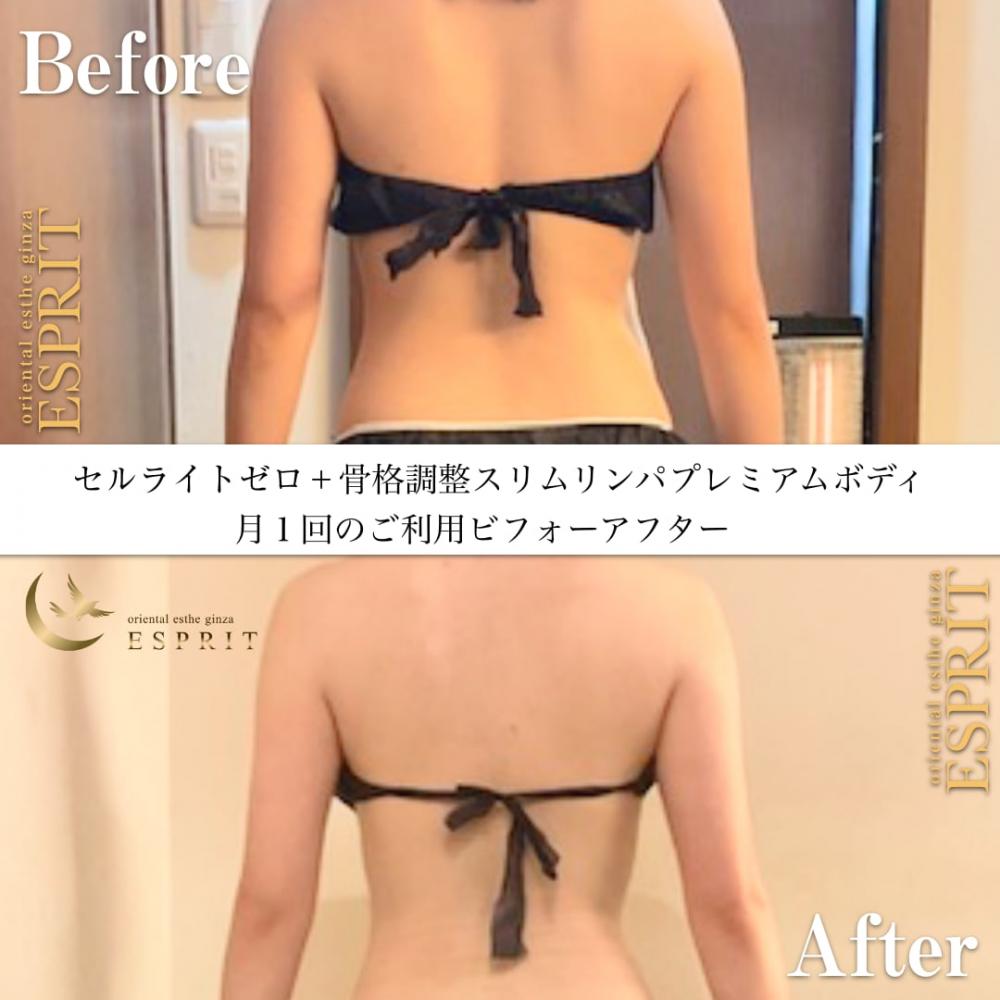 月一痩身エステで理想体型維持しています