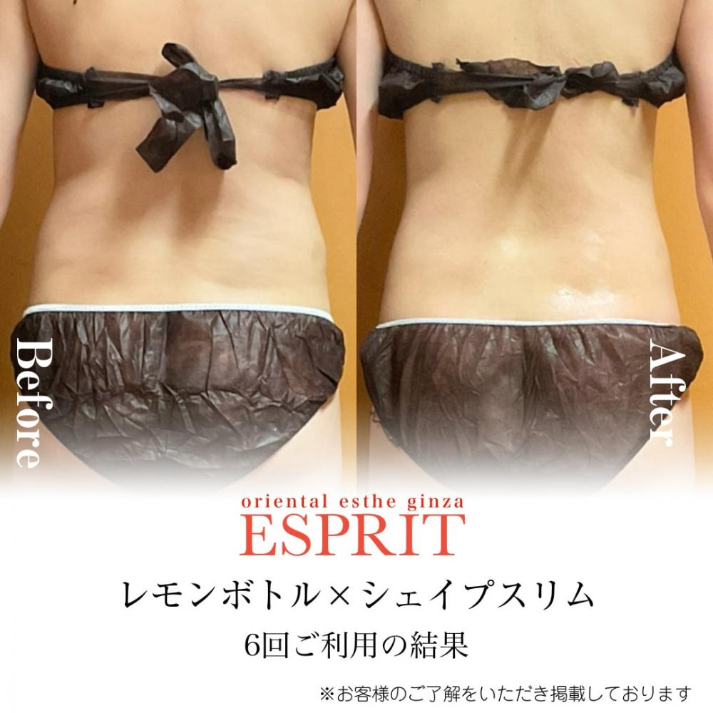 レモンボトルのセルライトケア!