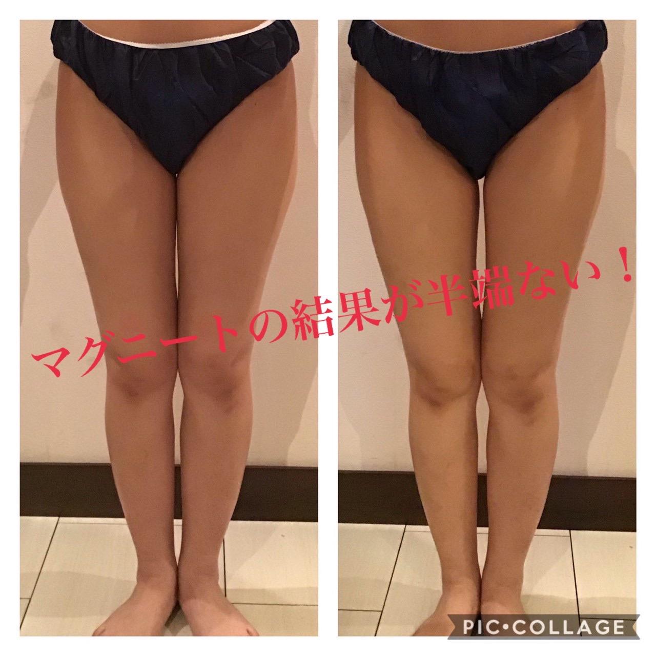スリミングキャンペーン 銀座 新宿の痩身 肌改善専門エステサロン エスプリ